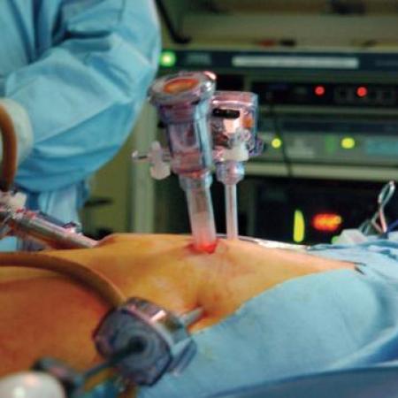 Evolving port technology for laparoscopic surgery